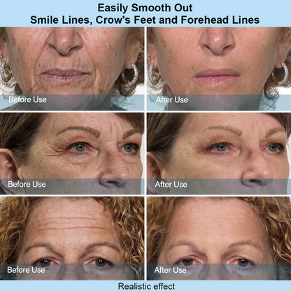 Instant Face Temporary Tightener – Instant visible results in 60 seconds