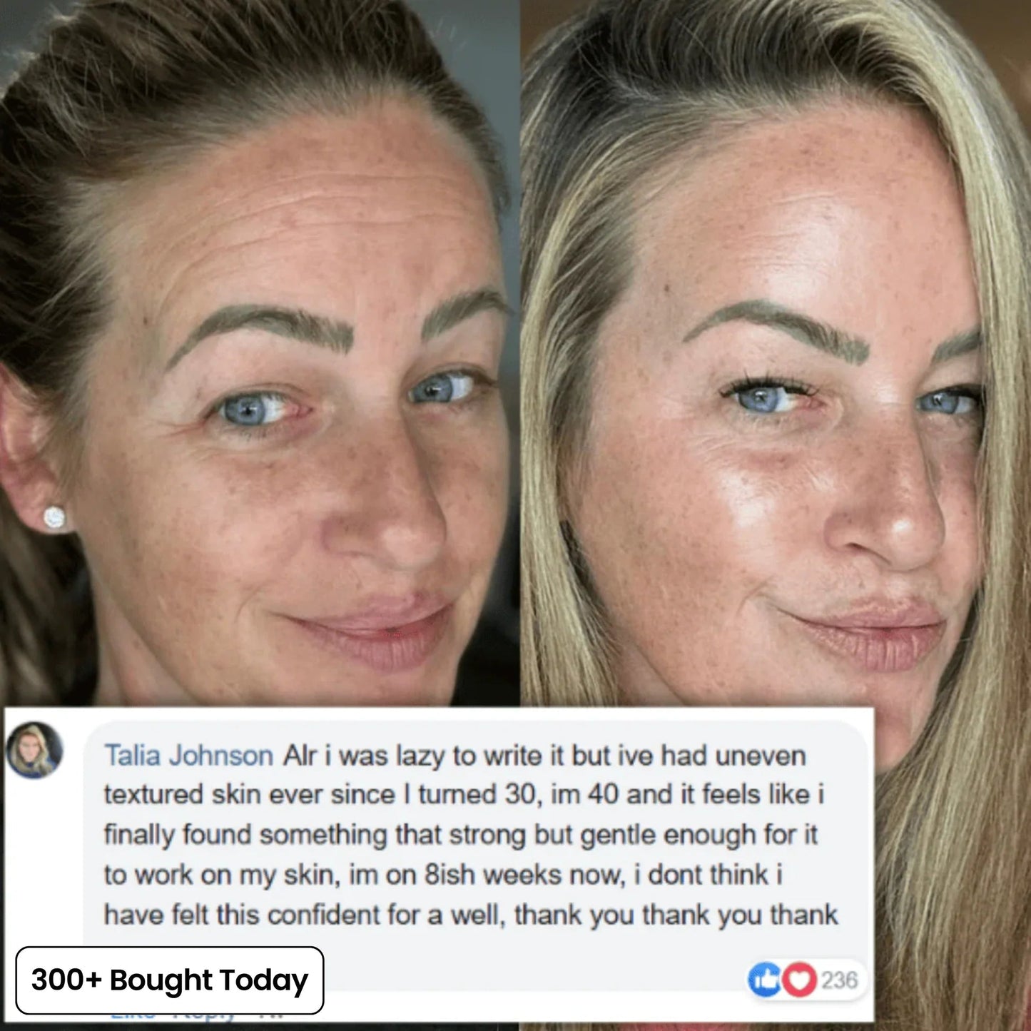 🔥Last day – BOGO - Sproforge Korean NAD+ EGF Firming Serum