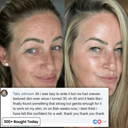 🔥Last day – BOGO - Sproforge Korean NAD+ EGF Firming Serum