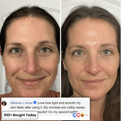 🔥Last day – BOGO - Sproforge Korean NAD+ EGF Firming Serum